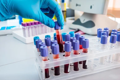 Hematology